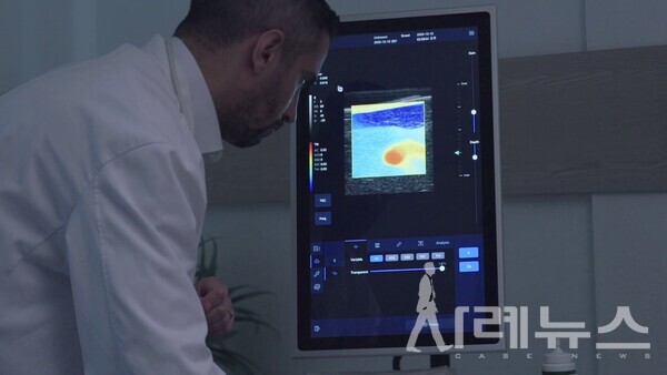 배럴아이 정량초음파[배럴아이 제공]